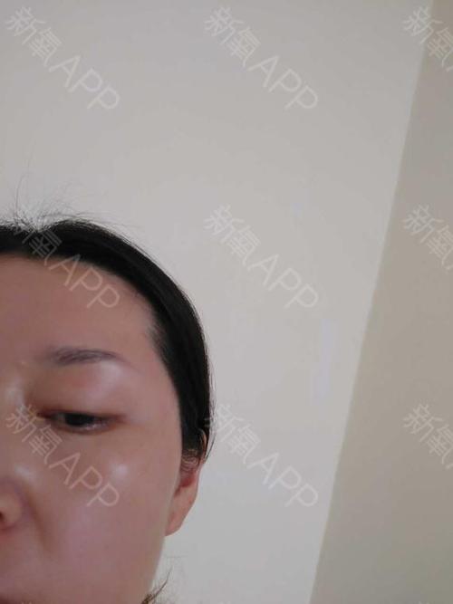 妈妈的鱼尾纹
