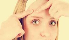 痘痘君，你不能这样