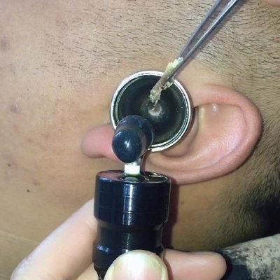 挖东西