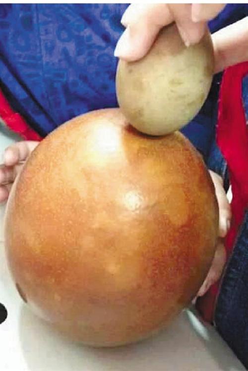 李霞蛋