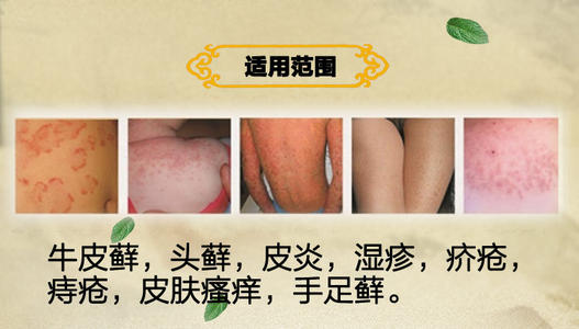 驱蚊