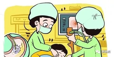 神经抽查