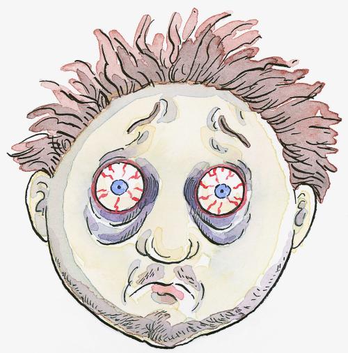 那些充血的眼睛