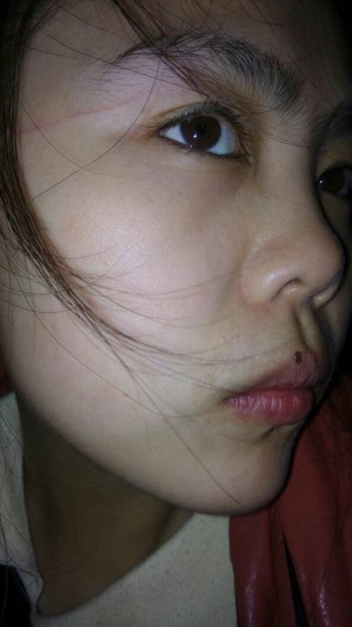 难以磨灭的伤疤