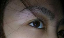 一道抹不去的疤痕