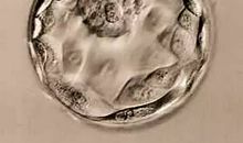 总会想起那一张照片