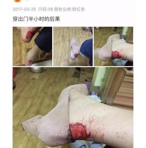 这是一个美丽的痛苦