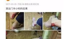 这是一种美丽的痛