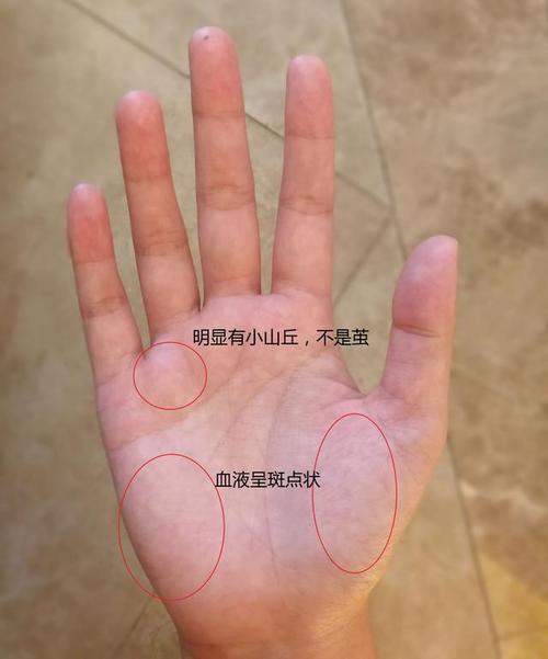 爱在你的手掌