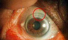 那一双浑浊的眼睛