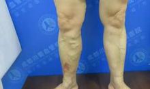 悄悄改变的南官河