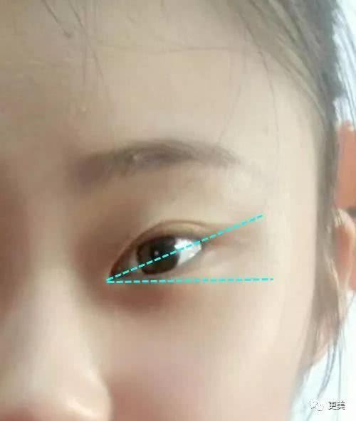 如果只有一只眼睛