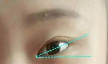 假如只有一只眼睛