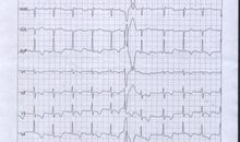 妈妈的心跳观后感