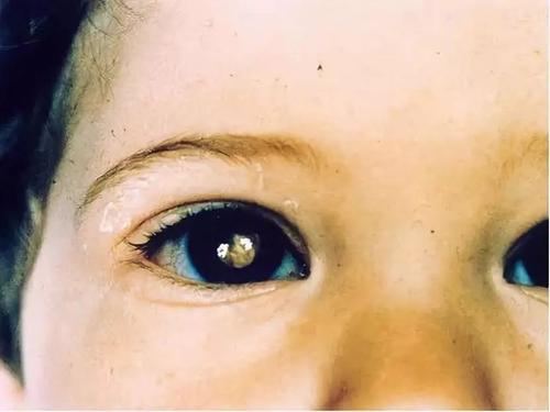 奇特的猫眼