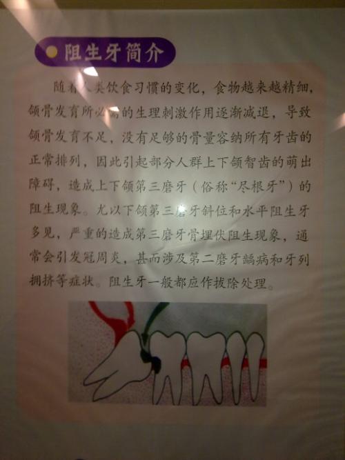 儿童拔牙的乐趣