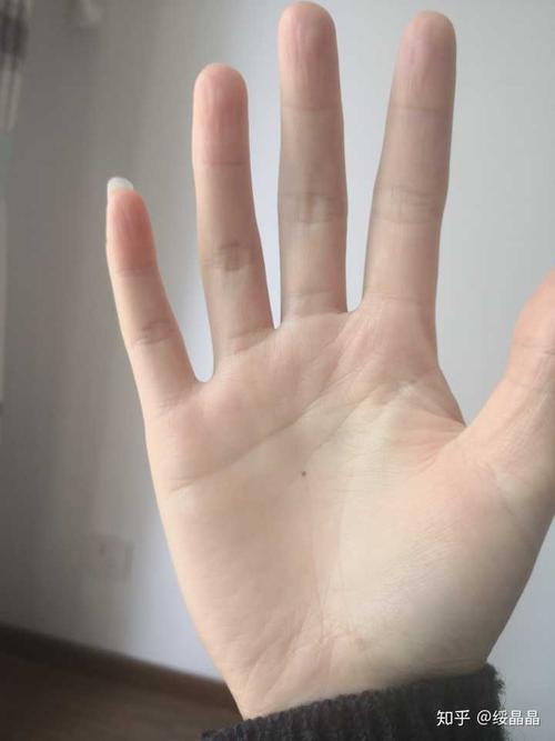手掌上的糖果