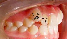 一颗牙齿的自述