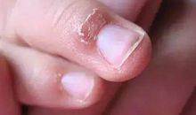 我给妈妈剪指甲