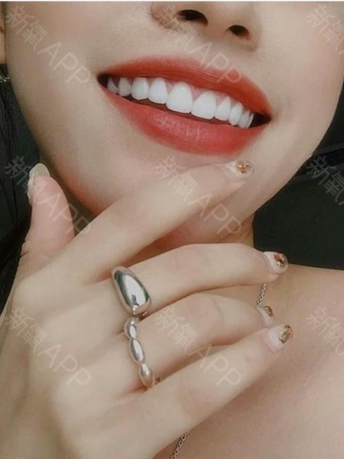 我和牙齿