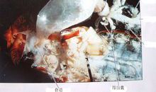 走进无脊椎动物的殿堂