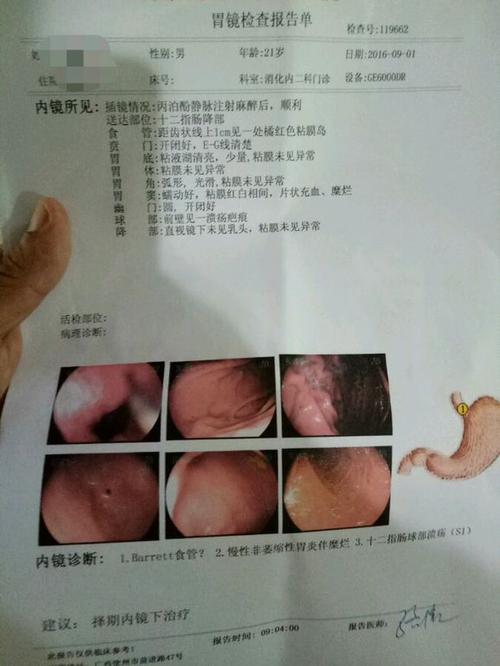 我的第一个发现