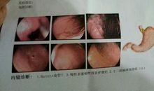 我的第一次发现