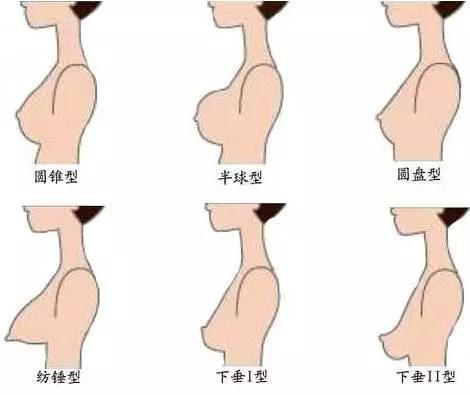 令人尴尬的事情