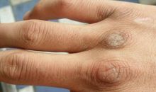 那双布满伤痕的手