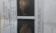 我刚吃下一粒变形药