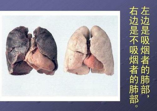 吸烟的后果