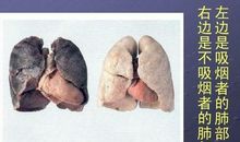 吸烟的后果
