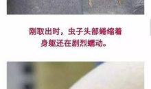 亲亲热热的“三条虫”