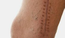 记忆深处的伤疤