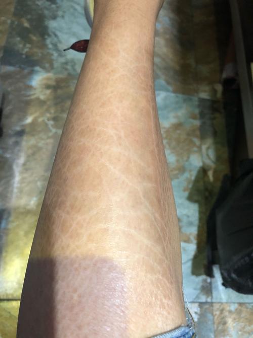 鱼的麻烦