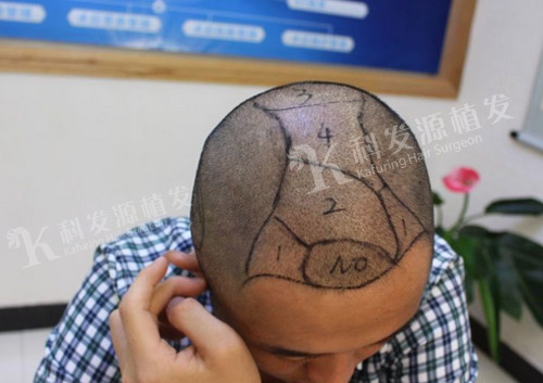 我尝到失败的痛苦