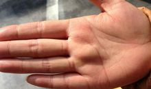 我和那“红红的手掌”