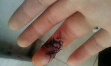 我珍贵的手指头