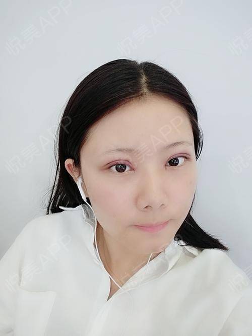 第一次纱布更换