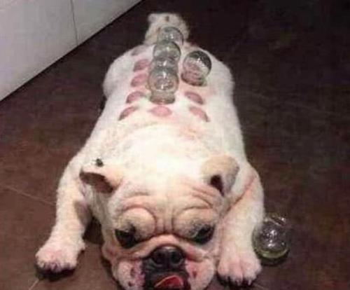 拔罐