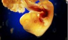 在痛苦中孕育美好