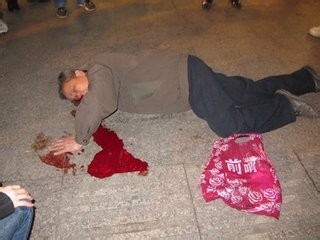 老人摔倒后