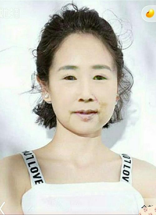 复活青年