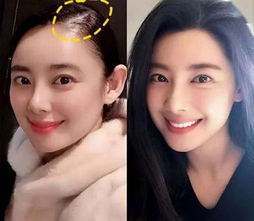 掉下来的头发
