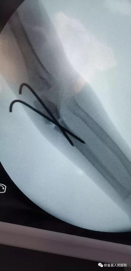 成功并不意味着过时