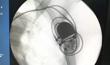 恍若血液植入我心