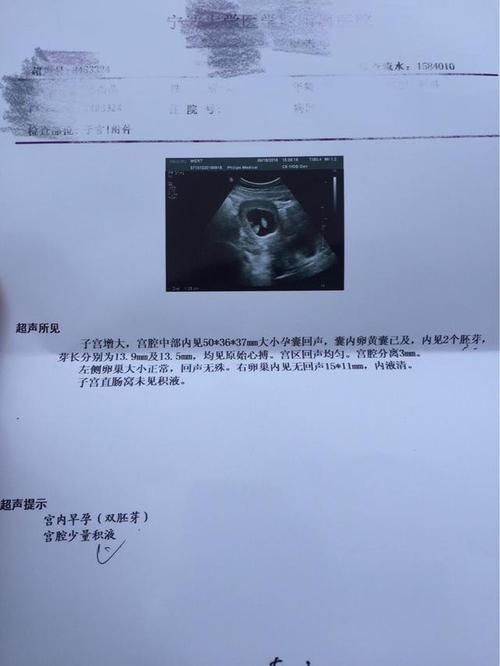第一次做B超