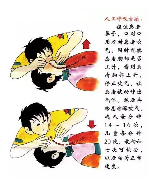 人工呼吸