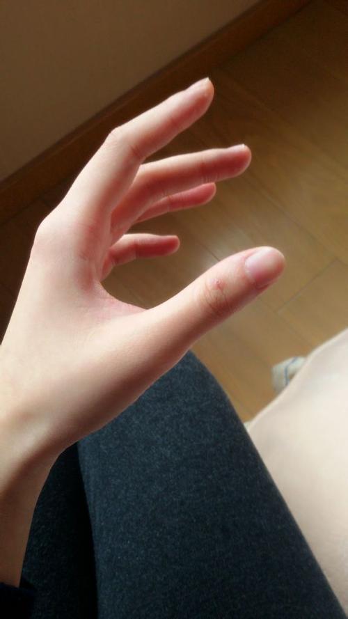 受伤后