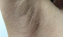 有疤痕的成长才是最美的